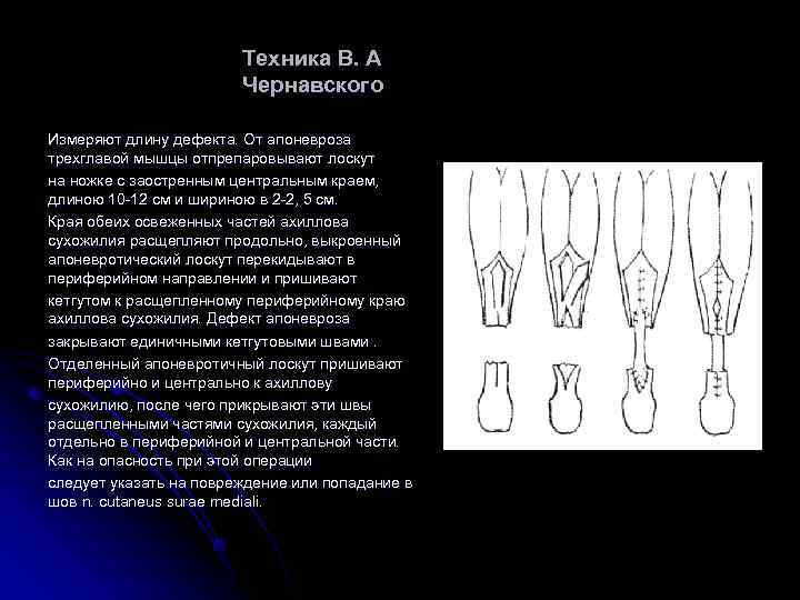     Техника В. А     Чернавского Измеряют длину