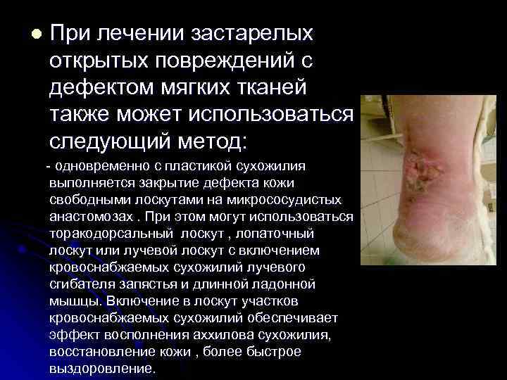 l  При лечении застарелых открытых повреждений с дефектом мягких тканей также может использоваться