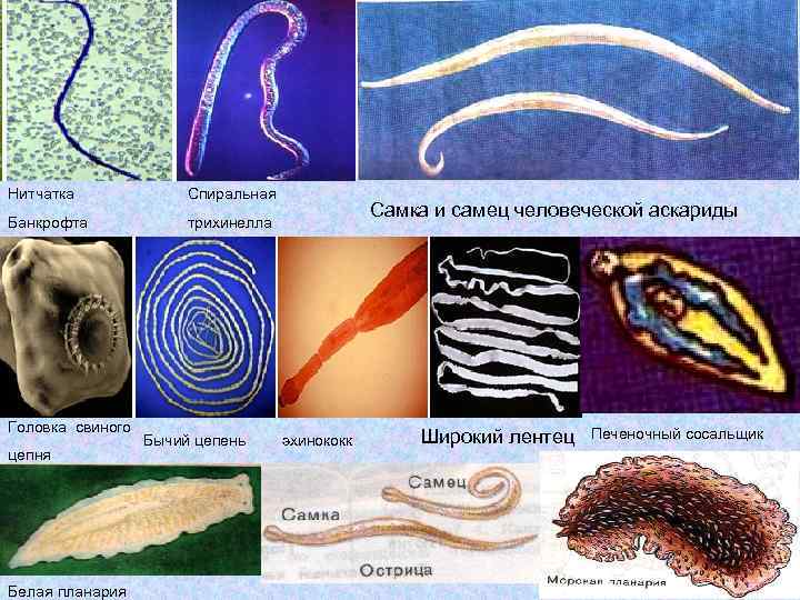 Нитчатка    Спиральная     Самка и самец человеческой аскариды