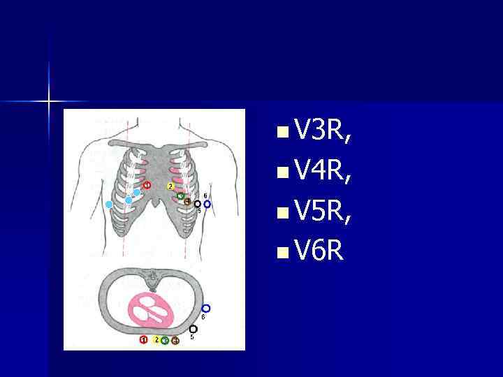 n V 3 R, n V 4 R, n V 5 R, n V 3 R, n V 4 R, n V 5 R,