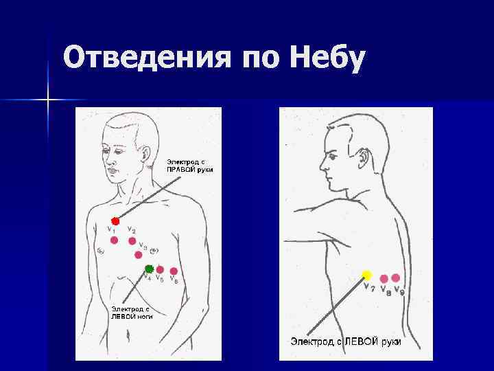 Отведения по Небу Отведения по Небу
