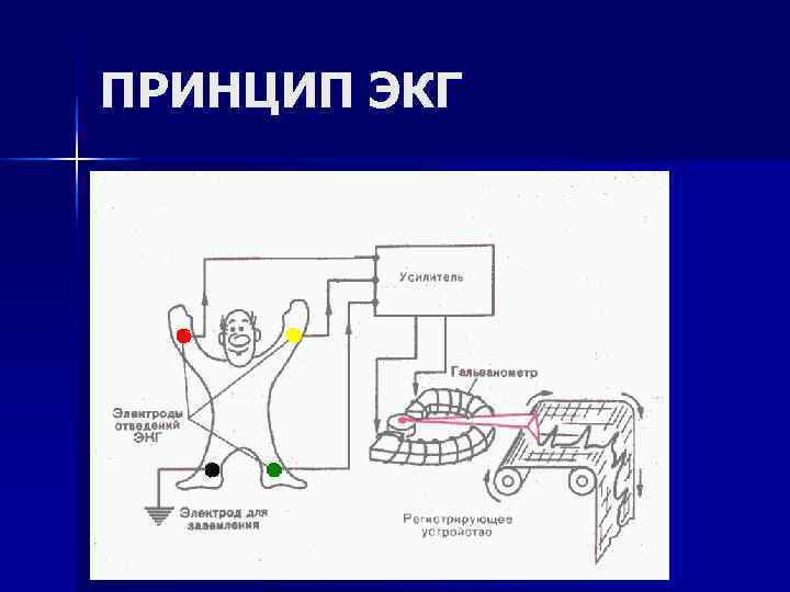 ПРИНЦИП ЭКГ ПРИНЦИП ЭКГ
