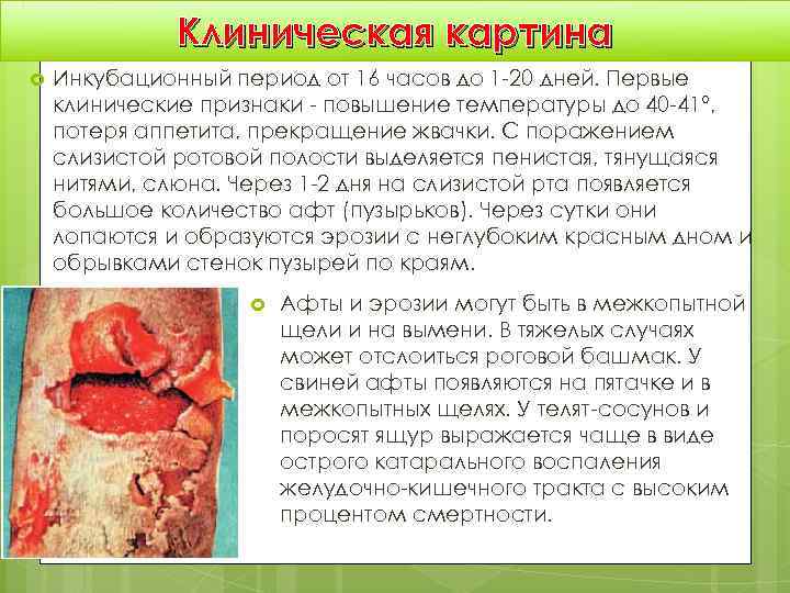    Клиническая картина Инкубационный период от 16 часов до 1 -20 дней.