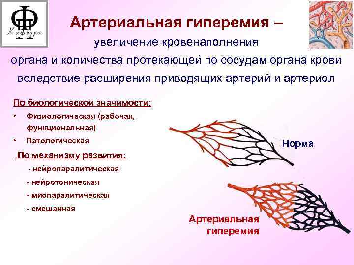 Признаки венозной гиперемии рисунок