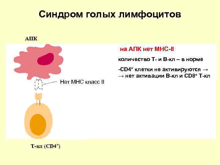  Синдром голых лимфоцитов АПК      на АПК нет MHC-II