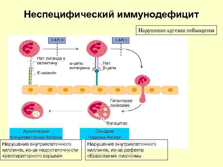   Неспецифический иммунодефицит      Нарушение адгезии лейкоцитов 