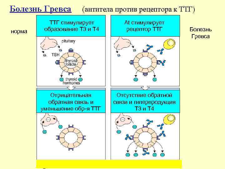 Болезнь Гревса  (антитела против рецептора к ТТГ)  ТТГ стимулирует   At