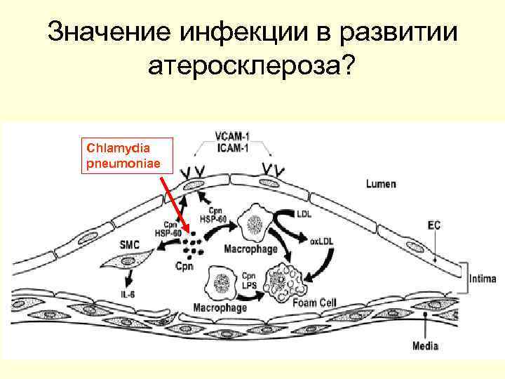 Значение инфекции в развитии  атеросклероза? Сhlamydia  pneumoniae 