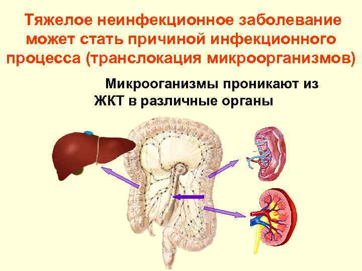  Тяжелое неинфекционное заболевание  может стать причиной инфекционного процесса (транслокация микроорганизмов)  Микрооганизмы