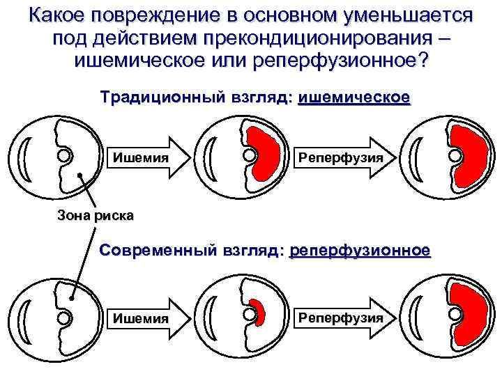 Какое повреждение в основном уменьшается под действием прекондиционирования – ишемическое или реперфузионное? Какое повреждение в основном уменьшается под действием прекондиционирования – ишемическое или реперфузионное?