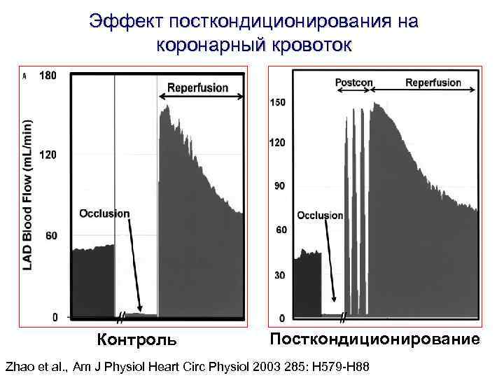Эффект посткондиционирования на коронарный кровоток Эффект посткондиционирования на коронарный кровоток
