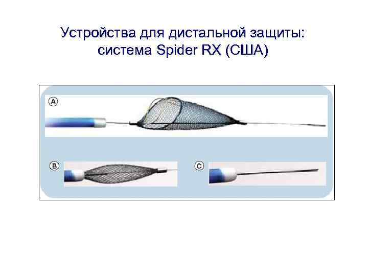 Устройства для дистальной защиты: система Spider RX (США) Устройства для дистальной защиты: система Spider RX (США)