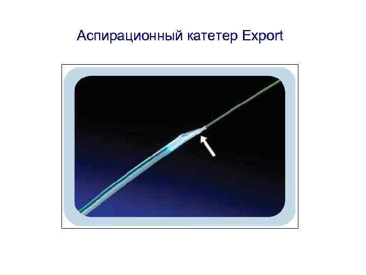 Аспирационный катетер Export Аспирационный катетер Export