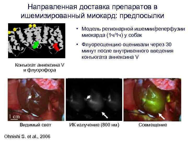 Направленная доставка препаратов в ишемизированный миокард: предпосылки Направленная доставка препаратов в ишемизированный миокард: предпосылки