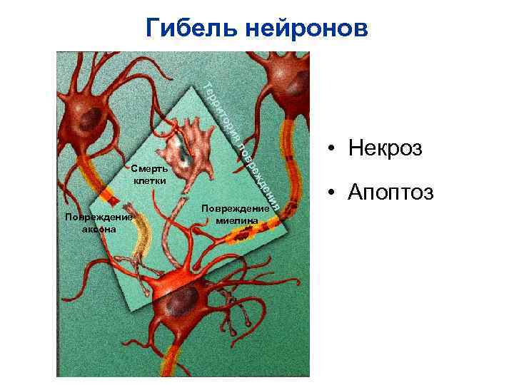 Картина смерть нейрона