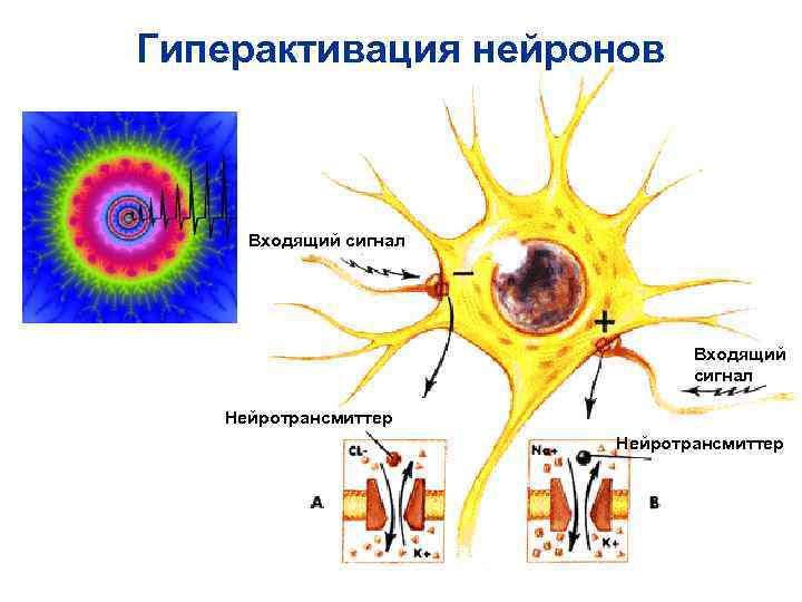 Гиперактивация нейронов Входящий сигнал Входящий Гиперактивация нейронов Входящий сигнал Входящий