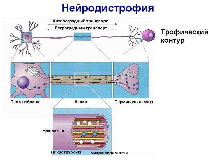 Нейродистрофия Антероградный транспорт Нейродистрофия Антероградный транспорт