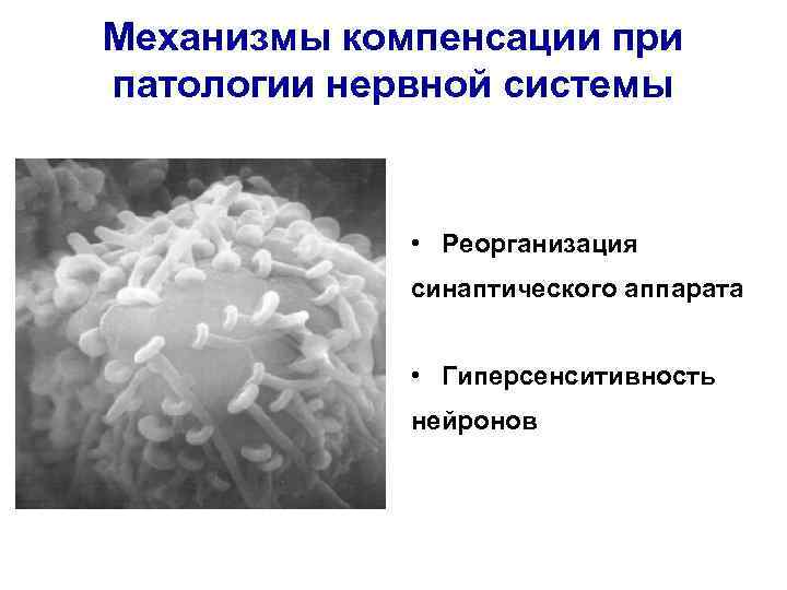 Механизмы компенсации при патологии нервной системы • Реорганизация синаптического аппарата Механизмы компенсации при патологии нервной системы • Реорганизация синаптического аппарата