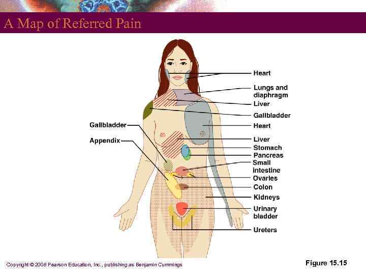 A Map of Referred Pain Copyright © 2008 Pearson Education, Inc. , publishing as
