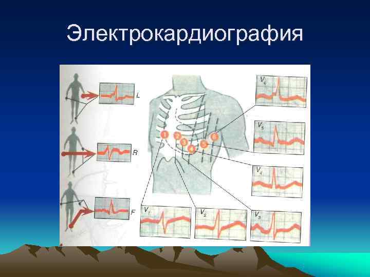 Электрокардиография 