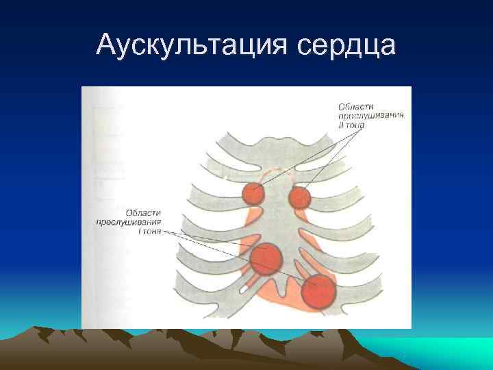 Аускультация сердца 
