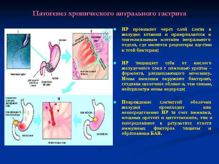 Патогенез хронического антрального гастрита    n  HР проникает через слой слизи