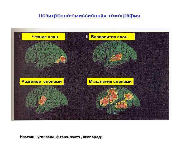ПЭТ различных отделов мозга при восприятии речи  Позитронно-эмиссионная томография   Чтение слов