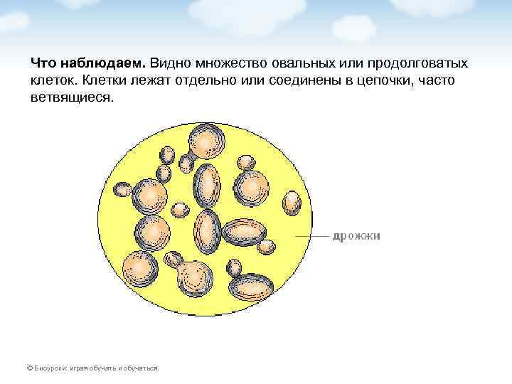 Что наблюдаем. Видно множество овальных или продолговатых клеток. Клетки лежат отдельно или соединены в