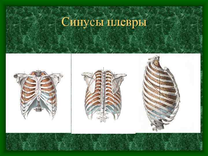Синусы плевры 