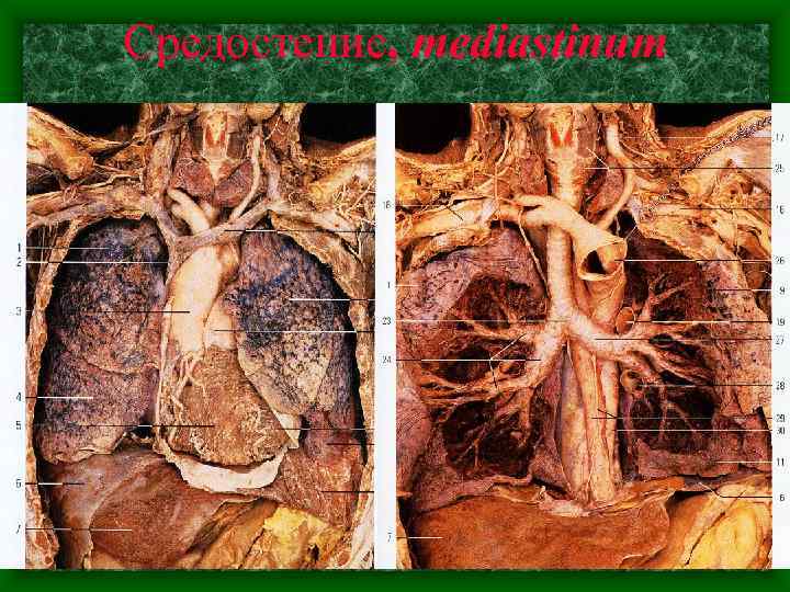Средостение, mediastinum 