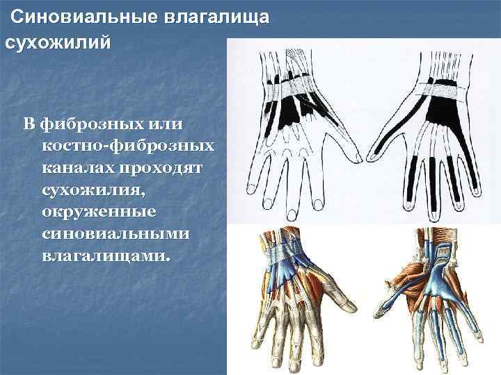 Синовиальные влагалища сухожилий В фиброзных или  костно-фиброзных  каналах проходят  сухожилия, окруженные