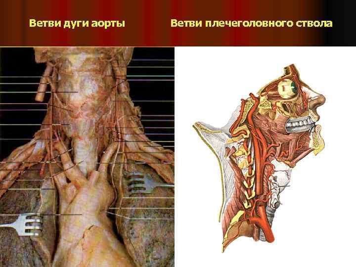 Ветви дуги аорты  Ветви плечеголовного ствола 