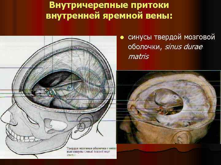  Внутричерепные притоки внутренней яремной вены:    l  cинусы твердой мозговой