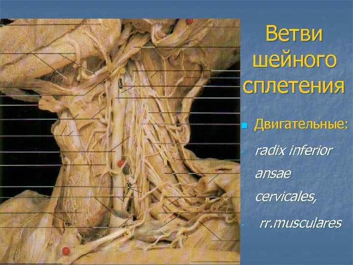  Ветви шейного сплетения n  Двигательные: -  radix inferior ansae cervicales, -