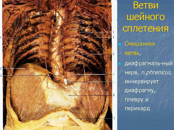  Ветви шейного сплетения n  Смешанная ветвь, n  диафрагмаль-ный нерв, n. phrenicus,