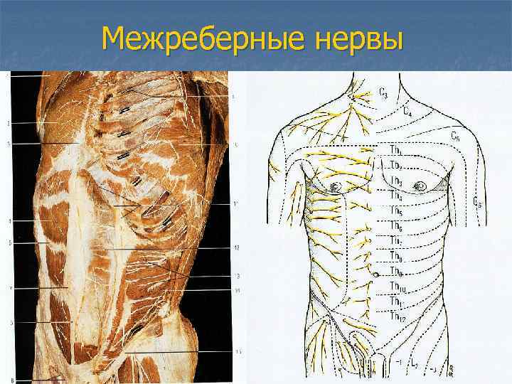 Межреберные нервы 