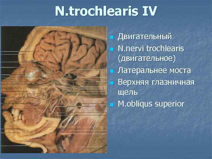 N. trochlearis IV   n  Двигательный   n  N. nervi
