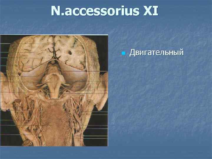N. accessorius XI   n  Двигательный 