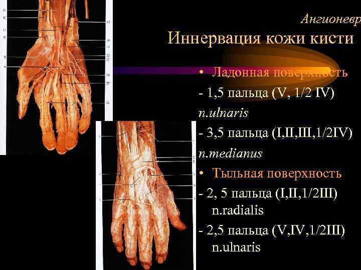      Ангионевр Иннервация кожи кисти • Ладонная поверхность  -
