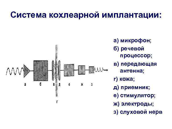 Система кохлеарной имплантации:    а) микрофон;    б) речевой 