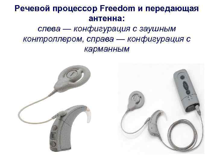 Речевой процессор Freedom и передающая   антенна:  слева — конфигурация с заушным