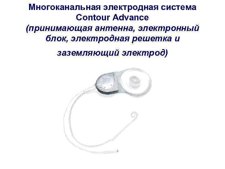  Многоканальная электродная система  Contour Advance (принимающая антенна, электронный блок, электродная решетка и