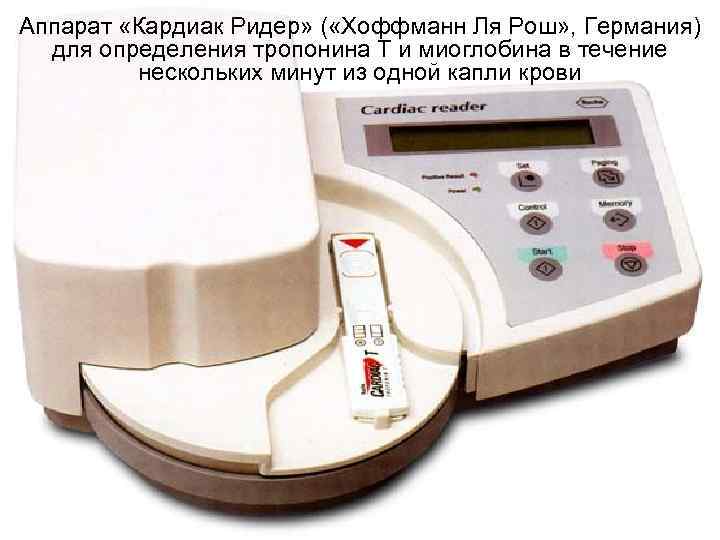 Аппарат «Кардиак Ридер» ( «Хоффманн Ля Рош» , Германия) для определения тропонина Т Аппарат «Кардиак Ридер» ( «Хоффманн Ля Рош» , Германия) для определения тропонина Т