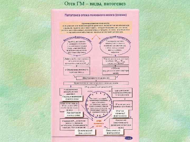Отек ГМ – виды, патогенез Отек ГМ – виды, патогенез