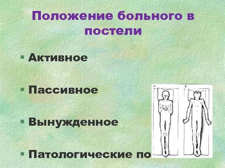 Положение пациента. Активное и пассивное положение больного. Активное пассивное и вынужденное положение больного. Активное положение больного. Положение больного в постели активное пассивное вынужденное.