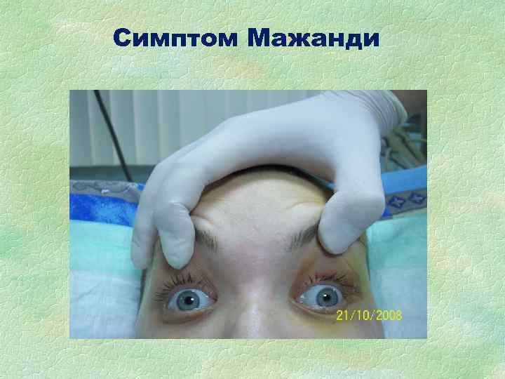 Симптом Мажанди Симптом Мажанди