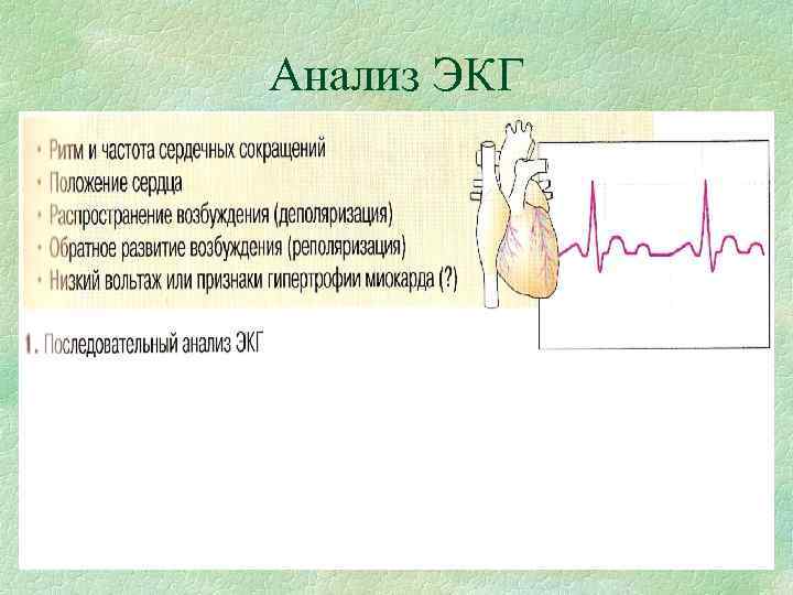Анализ ЭКГ Анализ ЭКГ
