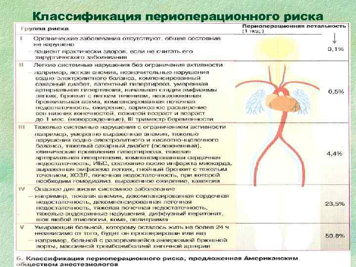 Классификация периоперационного риска Классификация периоперационного риска