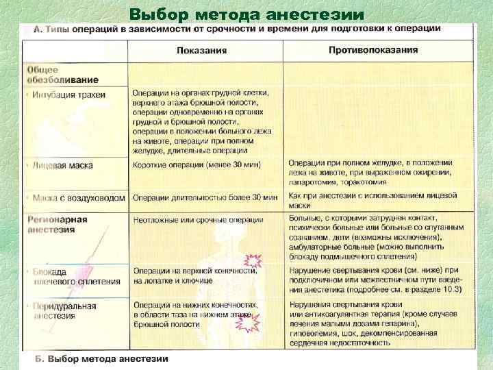 Выбор метода анестезии Выбор метода анестезии
