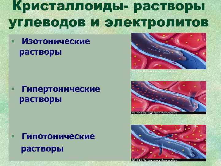 Кристаллоиды- растворы углеводов и электролитов § Изотонические растворы § Гипертонические растворы Кристаллоиды- растворы углеводов и электролитов § Изотонические растворы § Гипертонические растворы